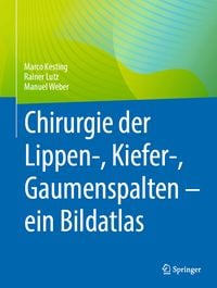 Produktbild: Chirurgie der Lippen-, Kiefer-, Gaumenspalten &ndash; ein Bildatlas