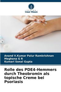 Produktbild: Rolle des PDE4-Hemmers durch Theobromin als topische Creme bei Psoriasis