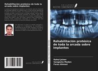 Produktbild: Rehabilitaci&oacute;n prot&eacute;sica de toda la arcada sobre implantes