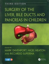 Produktbild: Surgery of the Liver, Bile Ducts and Pancreas in Children