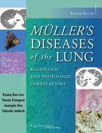 Produktbild: Mullers Diseases Of The Lung 2