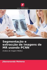 Produktbild: Segmenta&ccedil;&atilde;o e extrac&ccedil;&atilde;o de imagens de MR usando PCNN