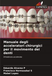 Produktbild: Manuale degli acceleratori chirurgici per il movimento dei denti