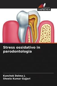 Produktbild: Stress ossidativo in parodontologia