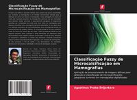 Produktbild: Classifica&ccedil;&atilde;o Fuzzy de Microcalcifica&ccedil;&atilde;o em Mamografias