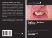 Produktbild: Implantes dentales inmediatos