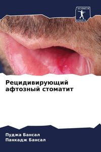 Produktbild: Recidiwiru&uuml;schij aftoznyj stomatit