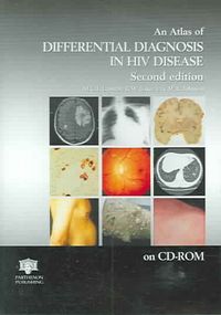 Produktbild: Atlas of HIV Disease, Second Edition CD-ROM