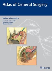 Bild vom Artikel Atlas of General  Surgery vom Autor Volker Schumpelick