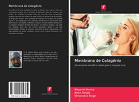 Produktbild: Membrana de Colag&eacute;nio