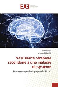 Produktbild: Vascularite c&eacute;r&eacute;brale secondaire &agrave; une maladie de syst&egrave;me