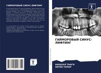 Produktbild: Gajmorovyj Sinus-Lifting