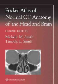 Produktbild: Pocket Atlas of Normal CT Anatomy of the Head and Brain