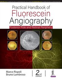 Produktbild: Practical Handbook of Fluorescein Angiography