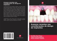 Produktbild: Avan&ccedil;os recentes nas considera&ccedil;&otilde;es de design de implantes