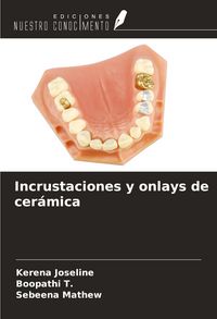 Produktbild: Incrustaciones y onlays de cer&aacute;mica
