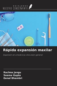 Produktbild: R&aacute;pida expansi&oacute;n maxilar