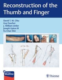 Produktbild: Reconstruction of the Thumb and Finger