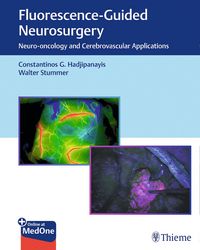 Produktbild: Fluorescence-Guided Neurosurgery