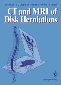 Produktbild: CT and MRI of Disk Herniations