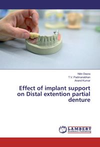 Produktbild: Effect of implant support on Distal extention partial denture