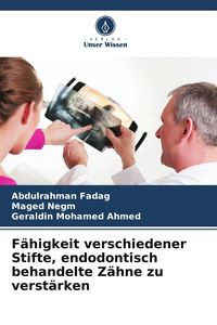 Produktbild: F&auml;higkeit verschiedener Stifte, endodontisch behandelte Z&auml;hne zu verst&auml;rken