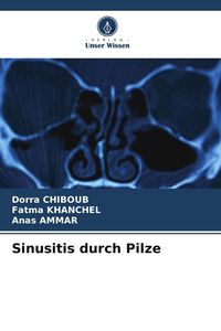 Produktbild: Sinusitis durch Pilze