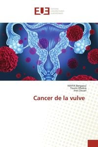 Produktbild: Cancer de la vulve