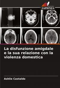 Produktbild: La disfunzione amigdale e la sua relazione con la violenza domestica