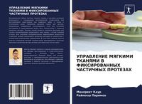 Produktbild: Upravlenie Myagkimi Tkanyami V Fiksirovannyh Chastichnyh Protezah