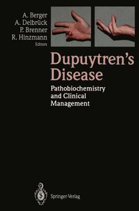 Produktbild: Dupuytren's Disease