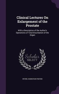 Produktbild: Clinical Lectures On Enlargement of the Prostate