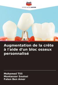 Produktbild: Augmentation de la cr&ecirc;te &agrave; l'aide d'un bloc osseux personnalis&eacute;