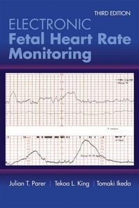 Produktbild: Electronic Fetal Heart Rate Monitoring: The 5-Tier System