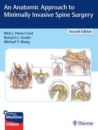 Produktbild: An Anatomic Approach to Minimally Invasive Spine Surgery