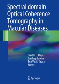 Produktbild: Spectral Domain Optical Coherence Tomography in Macular Diseases