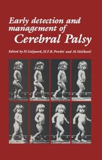 Produktbild: Early Detection and Management of Cerebral Palsy