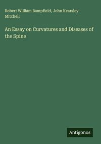 Produktbild: An Essay on Curvatures and Diseases of the Spine