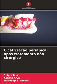 Produktbild: Cicatriza&ccedil;&atilde;o periapical ap&oacute;s tratamento n&atilde;o cir&uacute;rgico
