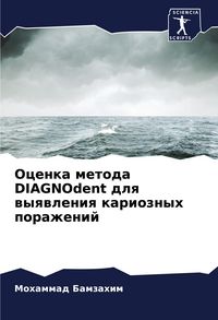 Produktbild: Ocenka metoda DIAGNOdent dlq wyqwleniq karioznyh porazhenij