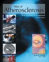 Produktbild: Atlas of Atherosclerosis and Metabolic Syndrome