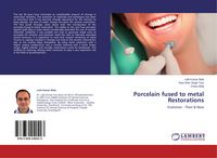 Produktbild: Porcelain fused to metal Restorations