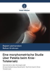 Produktbild: Eine morphometrische Studie &uuml;ber Patella beim Knie-Totalersatz