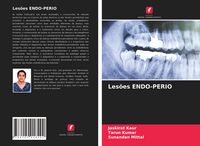 Produktbild: Les&otilde;es Endo-Perio