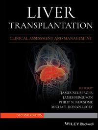 Produktbild: Liver Transplantation