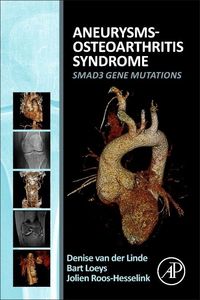 Produktbild: Aneurysms-Osteoarthritis Syndrome