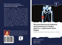 Produktbild: Ipsilateral'nyj perelom proximal'nogo bedra wmeste s perelomom wala bedra