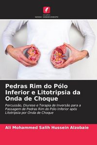 Produktbild: Pedras Rim do P&oacute;lo Inferior e Litotripsia da Onda de Choque