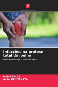 Produktbild: Infec&ccedil;&otilde;es na pr&oacute;tese total do joelho