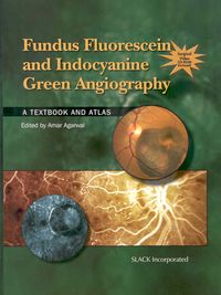 Produktbild: Fundus fluorescein and indocyanine